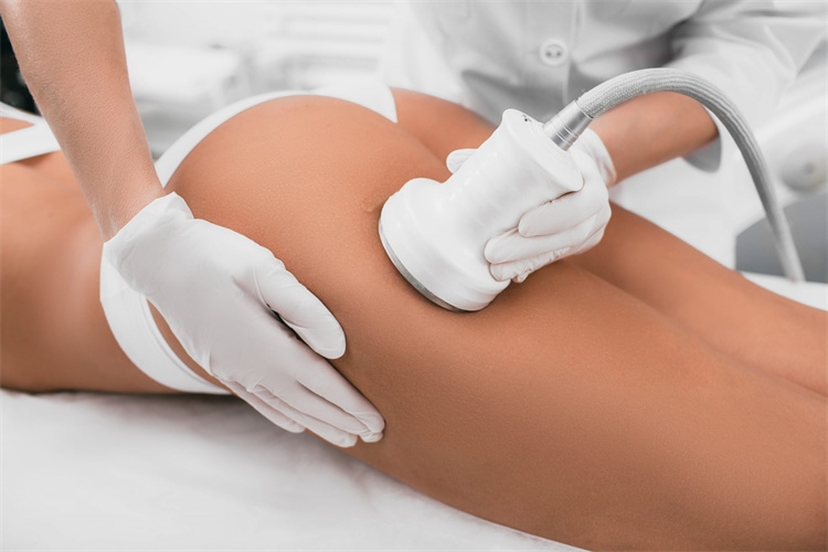 Are the results of ultrasonic cavitation permanent?