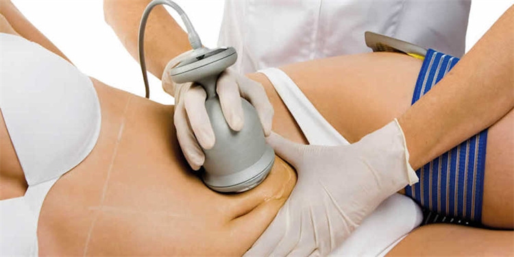 Does ultrasonic cavitation have any side effects?